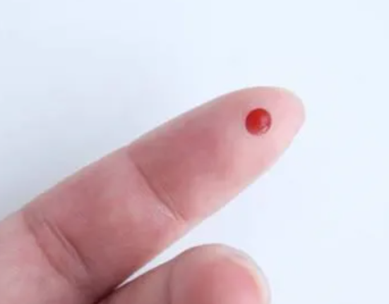 New measles test in Rwanda