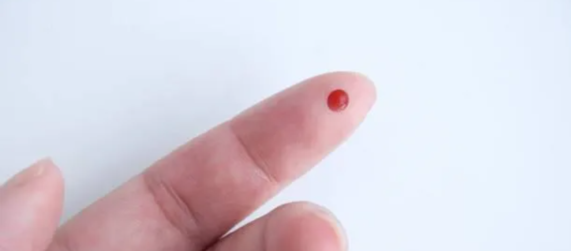 New measles test in Rwanda
